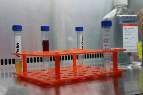 Plasticware — tubes, PCR strips, petri dishes